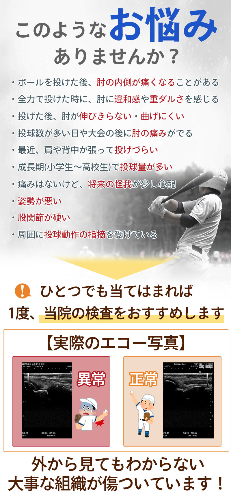 野球肘のお悩み